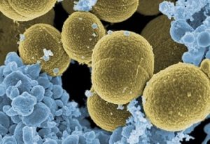 Staphylococcus aureus